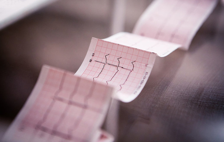 EKG Paper.jpg